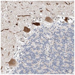 STARD9, Rabbit, Polyclonal Antibody, Abnova 100 &mu;L | Buy Online | Abnova Corporation | Fisher Scientific