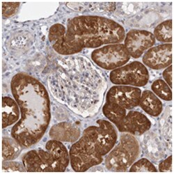 KCNJ12, Rabbit, Polyclonal Antibody, Abnova 100&mu;L; Unlabeled:Antibodies,