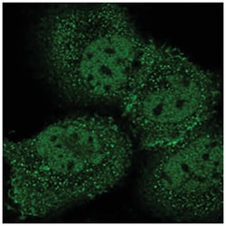 KIF18B Rabbit anti-Human, Polyclonal Antibody, Abnova 100&mu;L; Unlabeled:Antibodies,