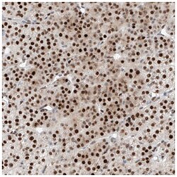 NT5C3L, Rabbit, Polyclonal Antibody, Abnova 100 &mu;L | Buy Online | Abnova Corporation | Fisher Scientific