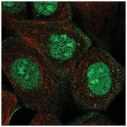 NT5C3L, Rabbit, Polyclonal Antibody, Abnova 100 &mu;L | Buy Online | Abnova Corporation | Fisher Scientific