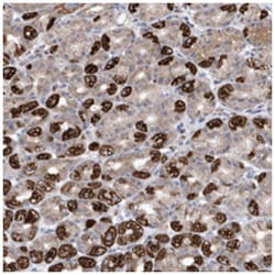 METTL8, Rabbit, Polyclonal Antibody, Abnova 100 &mu;L | Buy Online | Abnova Corporation | Fisher Scientific