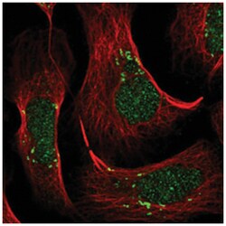 VWA5B2, Rabbit, Polyclonal Antibody, Abnova 100 &mu;L | Buy Online | Abnova Corporation | Fisher Scientific
