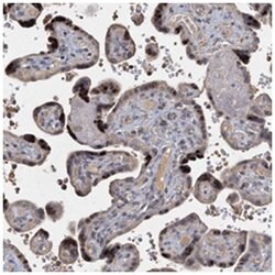 CCDC61, Rabbit, Polyclonal Antibody, Abnova 100 &mu;L | Buy Online | Abnova Corporation | Fisher Scientific