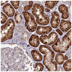 TBC1D30 Rabbit anti-Human, Polyclonal Antibody, Abnova 100&mu;L; Unlabeled:Anticuerpos