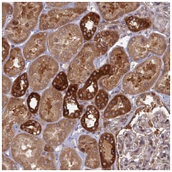 TBC1D30 Rabbit anti-Human, Polyclonal Antibody, Abnova 100 &mu;L | Buy Online | Abnova Corporation | Fisher Scientific