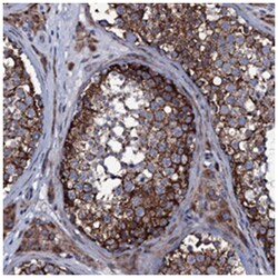 WIPF3 Rabbit anti-Human, Polyclonal Antibody, Abnova 100&mu;L; Unlabeled:Antibodies,