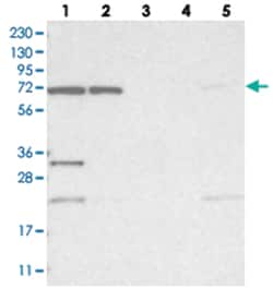 ZNF674, Rabbit, Polyclonal Antibody, Abnova 100 &mu;L | Buy Online | Abnova Corporation | Fisher Scientific