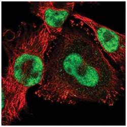 ZNF674, Rabbit, Polyclonal Antibody, Abnova 100 &mu;L | Buy Online | Abnova Corporation | Fisher Scientific