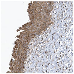 VPRBP, Rabbit, Polyclonal Antibody, Abnova 100 &mu;L | Buy Online | Abnova Corporation | Fisher Scientific