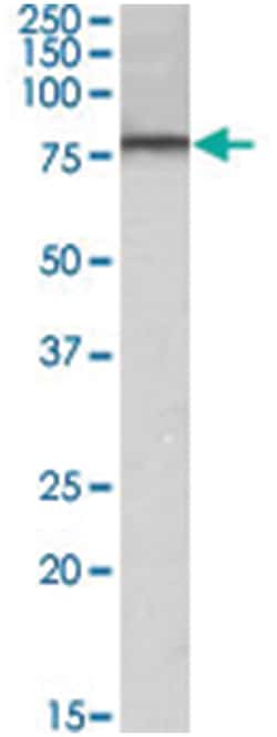 DYRK1A, Goat, Polyclonal Antibody, Abnova 100 &mu;g | Buy Online | Abnova Corporation | Fisher Scientific