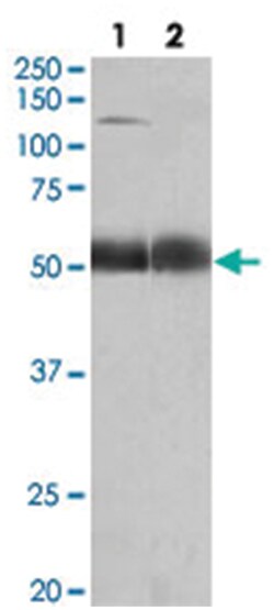 COPA, Goat, Polyclonal Antibody, Abnova 100&mu;g; Unlabeled:Antibodies,