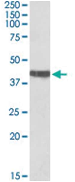 TNNT2, Goat, Polyclonal Antibody, Abnova 100 &mu;g | Buy Online | Abnova Corporation | Fisher Scientific