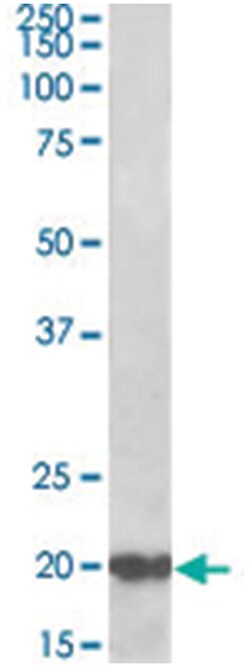DNAJC5, Goat, Polyclonal Antibody, Abnova 100 &mu;g | Buy Online | Abnova Corporation | Fisher Scientific