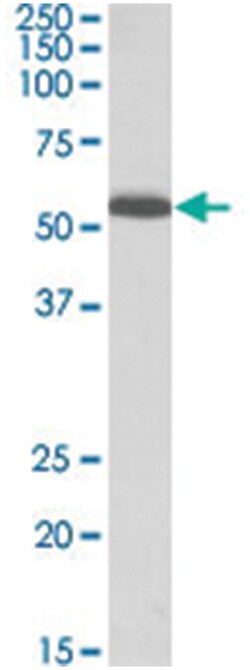 PCOLCE, Goat, Polyclonal Antibody, Abnova 100&mu;g; Unlabeled:Antibodies,