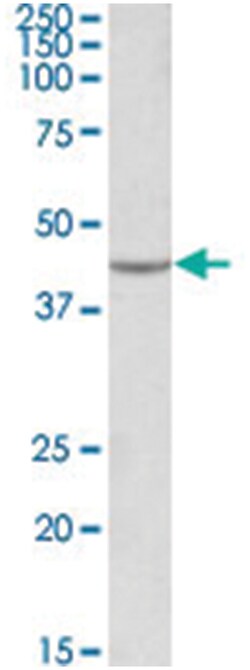 VEGFA, Goat, Polyclonal Antibody, Abnova 100 &mu;g | Buy Online | Abnova Corporation | Fisher Scientific