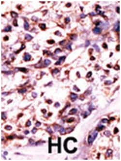 UCK2 Rabbit anti-Human, Polyclonal Antibody, Abnova 400&mu;L; Unlabeled:Antibodies,