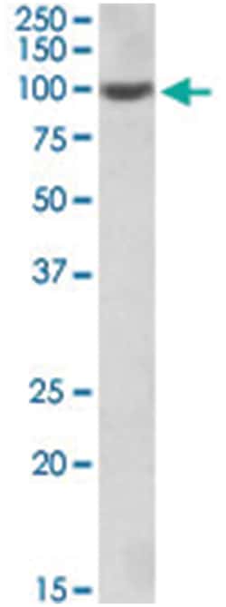 ICAM1, Goat, Polyclonal Antibody, Abnova 100 &mu;g | Buy Online | Abnova Corporation | Fisher Scientific