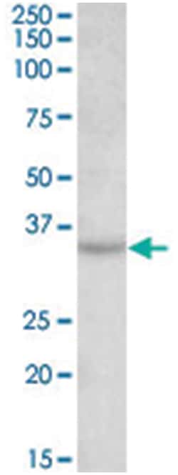TSPAN5, Goat, Polyclonal Antibody, Abnova 100 &mu;g | Buy Online | Abnova | Fisher Scientific