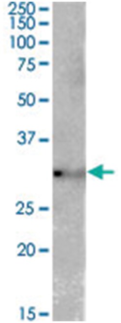 TSPAN14, Goat, Polyclonal Antibody, Abnova 100&mu;g; Unlabeled:Antibodies,