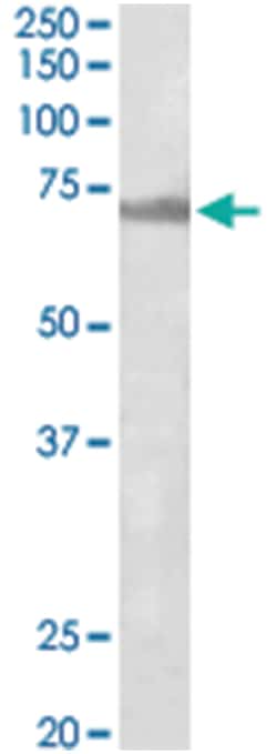 ENC1, Goat, Polyclonal Antibody, Abnova 100 &mu;g | Buy Online | Abnova Corporation | Fisher Scientific