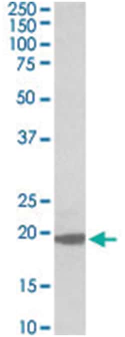 MCTS1, Goat, Polyclonal Antibody, Abnova 100&mu;g; Unlabeled:Antibodies,