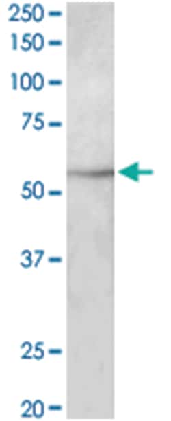 TUBB3, Goat, Polyclonal Antibody, Abnova 100 &mu;g | Buy Online | Abnova Corporation | Fisher Scientific