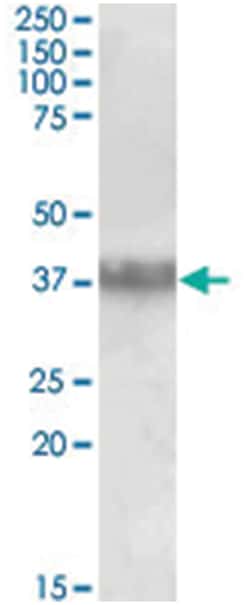 CLU Goat anti-Human, Polyclonal Antibody, Abnova 100 &mu;g | Buy Online | Abnova Corporation | Fisher Scientific
