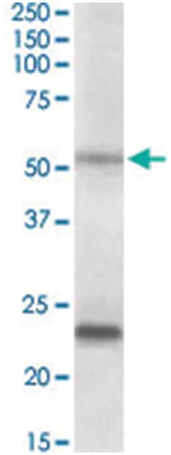 MMP3 Goat anti-Human, Polyclonal Antibody, Abnova 100&mu;g; Unlabeled:Antibodies,