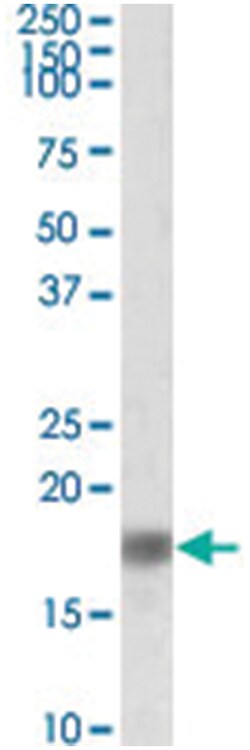 SNCA Goat anti-Human, Pig, Polyclonal Antibody, Abnova 100&mu;g; Unlabeled:Antibodies,