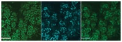 Smgc, Goat, Polyclonal Antibody, Abnova 100 &mu;g | Buy Online | Abnova Corporation | Fisher Scientific