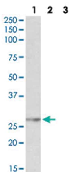 NMNAT3 Goat anti-Dog, Human, Polyclonal Antibody, Abnova 100 &mu;g | Buy Online | Abnova Corporation | Fisher Scientific