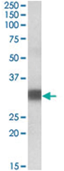 PDXP, Goat, Polyclonal Antibody, Abnova 100 &mu;g | Buy Online | Abnova Corporation | Fisher Scientific