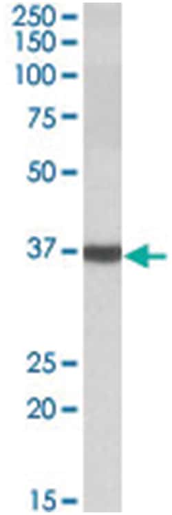 DAO Goat anti-Chicken, Dog, Human, Pig, Polyclonal Antibody, Abnova 100 &mu;g | Buy Online | Abnova Corporation | Fisher Scientific