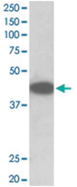 Trib1, Goat, Polyclonal Antibody, Abnova 100 &mu;g | Buy Online | Abnova Corporation | Fisher Scientific