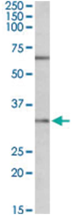 CASP3, Goat, Polyclonal Antibody, Abnova 100 &mu;g | Buy Online | Abnova Corporation | Fisher Scientific