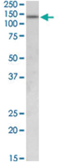 FBXL11, Goat, Polyclonal Antibody, Abnova 100 &mu;g | Buy Online | Abnova Corporation | Fisher Scientific