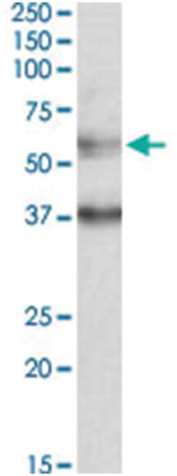 CBARA1, Goat, Polyclonal Antibody, Abnova 100&mu;g; Unlabeled:Antibodies,