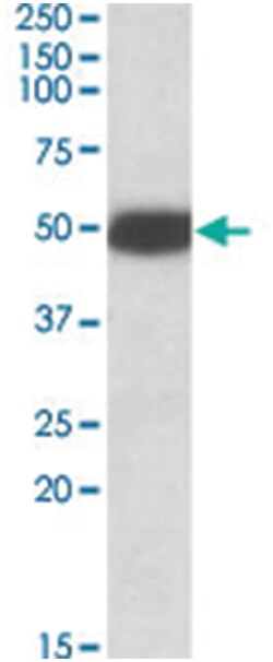HTR3B Goat anti-Rat, Polyclonal Antibody, Abnova 100 &mu;g | Buy Online | Abnova Corporation | Fisher Scientific
