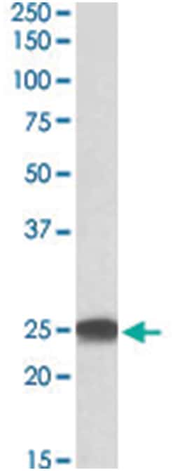 PSMB4 Goat anti-Chicken, Dog, Human, Mouse, Rabbit, Rat, Polyclonal Antibody, Abnova 100 &mu;g | Buy Online | Abnova Corporation | Fisher Scientific