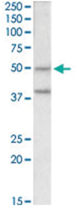 Mboat4, Goat, Polyclonal Antibody, Abnova 100 &mu;g | Buy Online | Abnova Corporation | Fisher Scientific