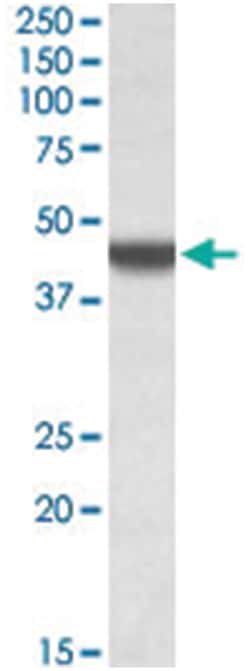 APOBEC3D, Goat, Polyclonal Antibody, Abnova 100 &mu;g | Buy Online | Abnova Corporation | Fisher Scientific