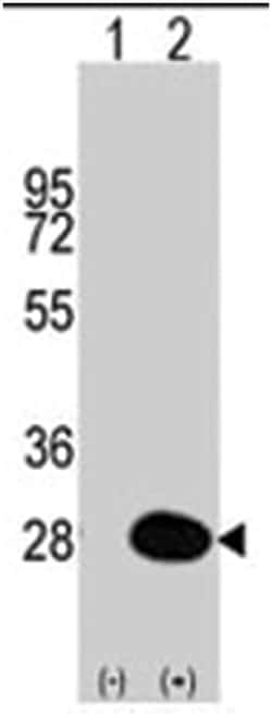 HSPB1 Rabbit anti-Human, Polyclonal Antibody, Abnova 400 &mu;L | Buy Online | Abnova Corporation | Fisher Scientific