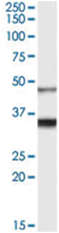 HCRTR1, Goat, Polyclonal Antibody, Abnova 100&mu;g; Unlabeled:Antibodies,