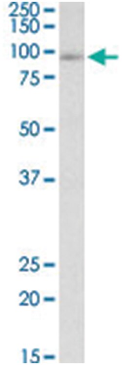 FYB, Goat, Polyclonal Antibody, Abnova 100 &mu;g | Buy Online | Abnova Corporation | Fisher Scientific