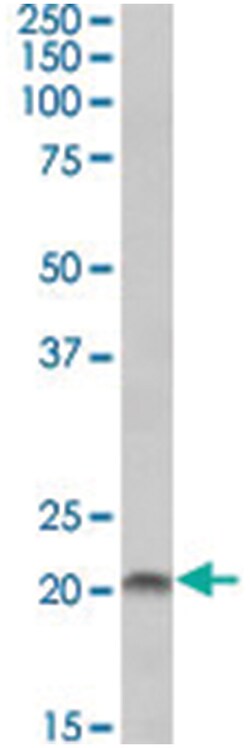 SPINT2 Goat anti-Chicken, Dog, Human, Mouse, Rat, Polyclonal Antibody,