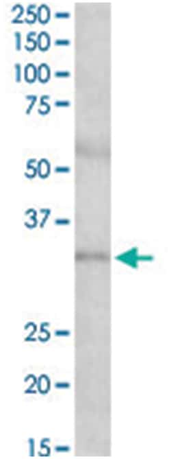 IGFBP1, Goat, Polyclonal Antibody, Abnova 100&mu;g; Unlabeled:Antibodies,