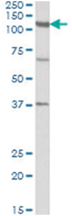 CP110, Goat, Polyclonal Antibody, Abnova 100&mu;g; Unlabeled:Antibodies,