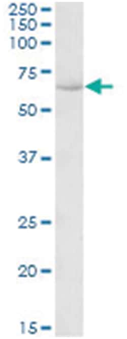 HSPA13, Goat, Polyclonal Antibody, Abnova 100 &mu;g | Buy Online | Abnova Corporation | Fisher Scientific