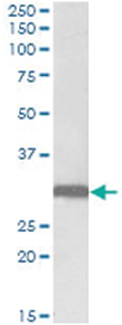 STOM, Goat, Polyclonal Antibody, Abnova 100&mu;g; Unlabeled:Antibodies,